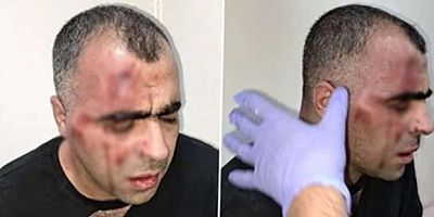 AKP’li Tatvan belediye başkanının korumaları gazeteciyi darp etti