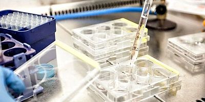 Avustralya’da Laboratuvarda Skandal: 323 Şişe Ölümcül Virüs Kayboldu